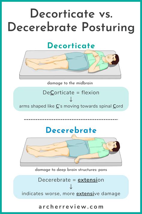 The two major types of posturing tested on the NCLEX are decorticate and decerebrate-each ...