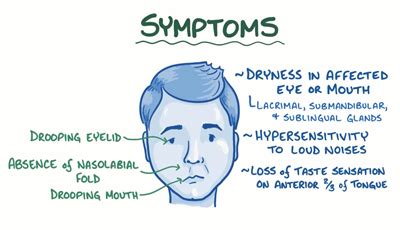 Bell's Palsy Symptoms / My Secret Personal Journey To Overcome Bells Palsy Quickly / However ...