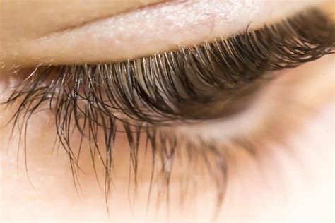 Eyelash Mites Causes and Prevention