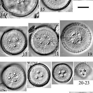 LM. Cyclotella paraocellata & Cyclotella ocellata Pantocsek. Figs... | Download Scientific Diagram