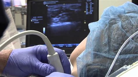 Ultrasound Guided Ulnar Nerve Block On Vimeo | Images and Photos finder