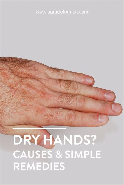 Dry Hands: Causes and Simple Remedies - Particle in 2021 | Skin care ...