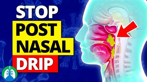 How To Get Rid Of Post Nasal Drip Cough - Informationwave17