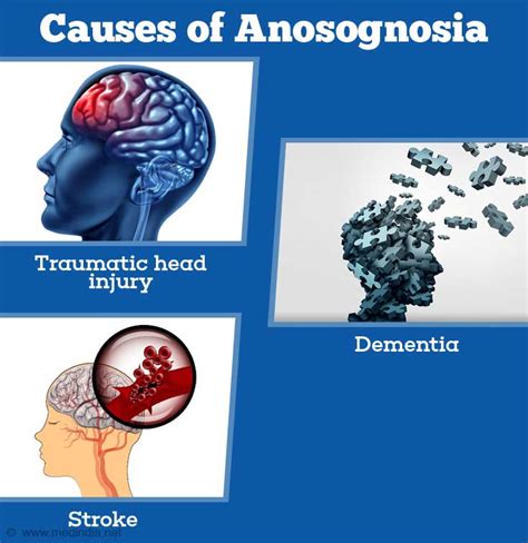 Anosognosia - Causes, Symptoms, Diagnosis, and Treatment