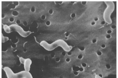 Campylobacter Jejuni: Disease, Properties and Laboratory diagnosis