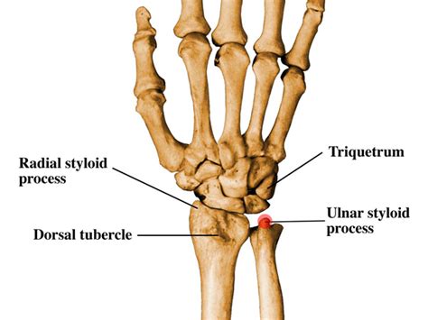 Injury to the styloid process?