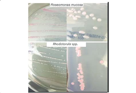 Colony morphology for Roseomonas mucosa and Rhodotorula spp. Colony... | Download Scientific Diagram