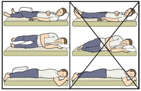 Figure 9. Sleeping positions after a hip replacement Hip Replacement ...