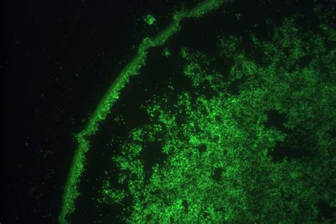 Chlamydophila pneumoniae by micro-immunoflurescence | International Journal of Clinical ...