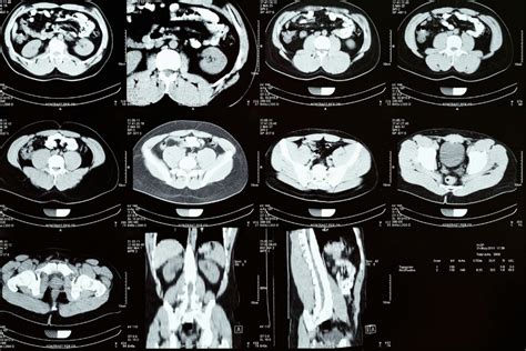 Tomografía de Columna en Mérida ¡Agenda Hoy! | CMA Hospital