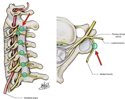 Nerves (Innervation of the Spine) | Musculoskeletal Key