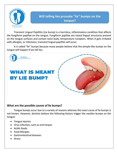 What causes lie bumps on the tongue? by PavaniJagat - Issuu