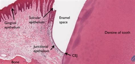 Junctional Epithelium Histology