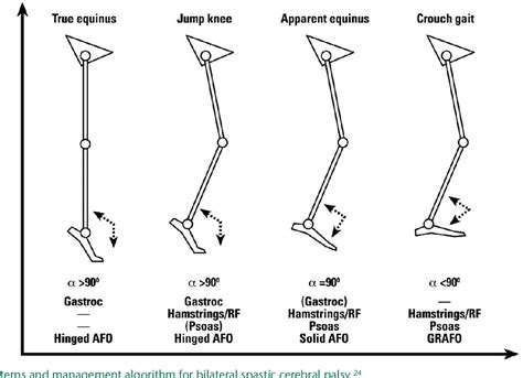 [PDF] Gait analysis in children with cerebral palsy | Semantic Scholar