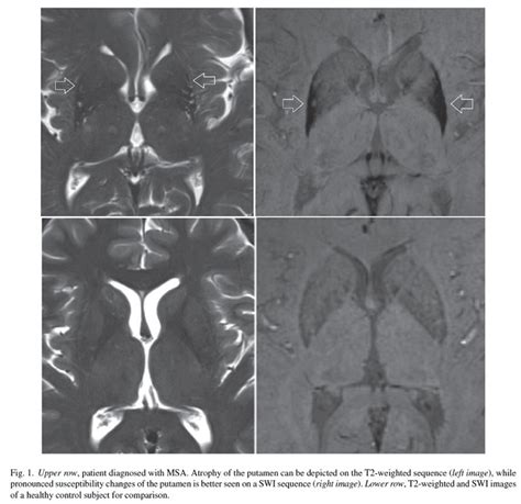 Clinical Application of Brain MRI in the Diagnostic Work-up of ...