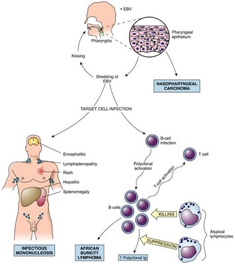 Epstein-barr virus infections; EBV Infections