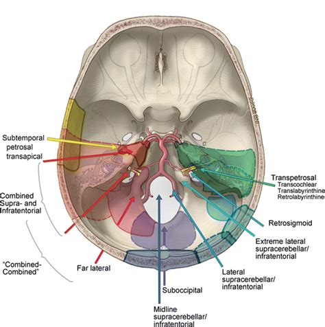 Posterior Fossa