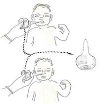 [Solved] While suctioning newborn babie's mouth and nose which&nb