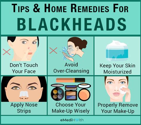 How to Get Rid of Blackheads at Home - eMediHealth