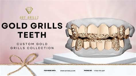 Gold Grills Teeth – Explore High-Quality Custom Gold Teeth Grills