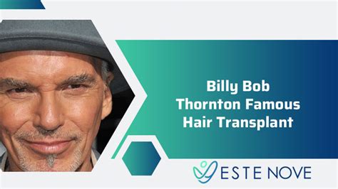 Billy Bob Thornton Famous Hair Transplant – Estenove