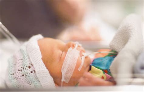 Mechanical Ventilation in Neonates | RT