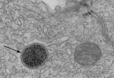 Lysosomes - Allan Liske