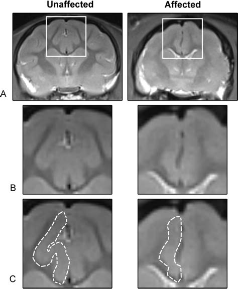 Changes in MRI are consistent with microcephaly and attenuation of... | Download Scientific Diagram