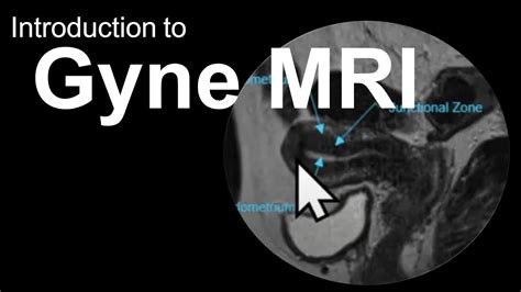 Introduction to Gyne MRI (Female Pelvis): Case-Based Course - YouTube