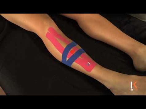 KT Tape: Shin Splints- Anterior - YouTube