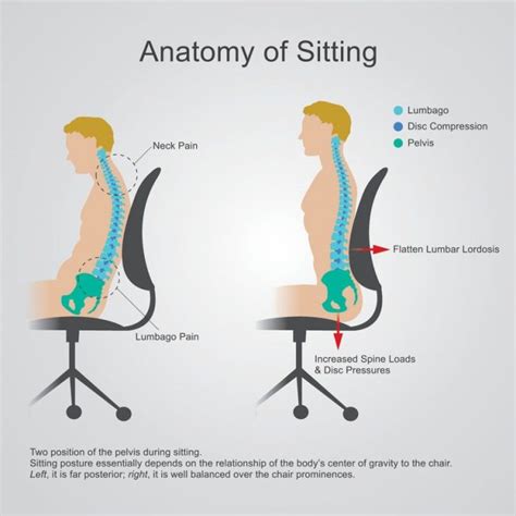 What is the Correct Ergonomic Sitting Posture in the Office?