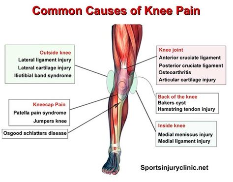 Common Causes of Knee Pain | Common causes of knee pain and … | Flickr