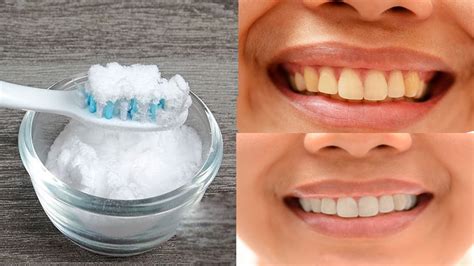 How to Use Baking Soda For Whiten Teeth - YouTube