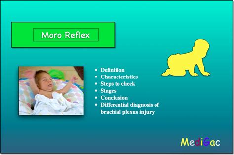 How to check Moro Reflex in Newborn babies – MediGac