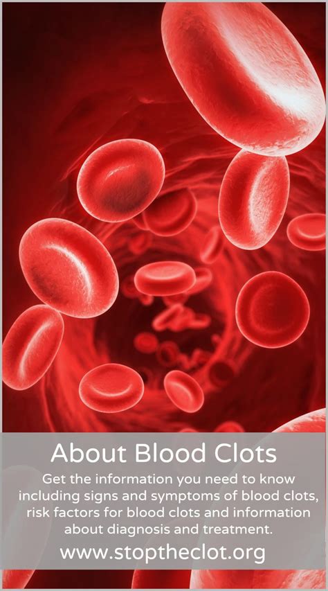 13 best About Blood Clots images on Pinterest