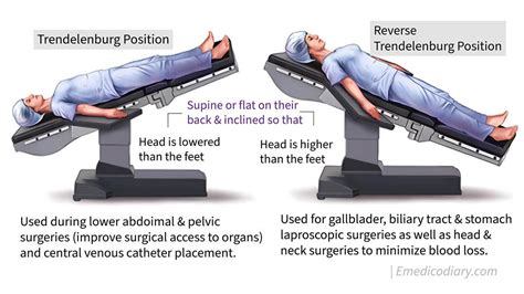 Modified Trendelenburg Position For Shock