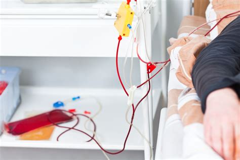 Plasmapheresis or Therapeutic Plasma Exchange - Facty Health