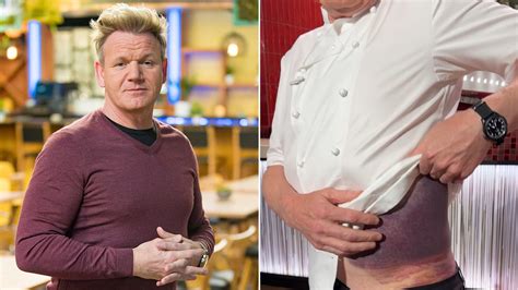 Gordon Ramsay ‘lucky’ to be alive following serious bicycle accident ...