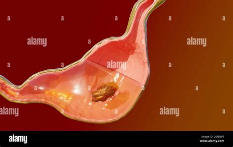 3d Illustration of Human Stomach Anatomy Digestion, 3D reander Stock Photo - Alamy