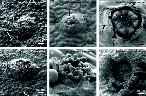 The development of the different rust pustules, an overview illustrated... | Download Scientific ...