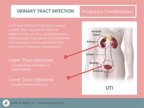 UTI - Urinary Tract Infection | www.abclawcenters.com/practi… | Flickr