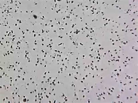 Human sperm under a microscope - YouTube