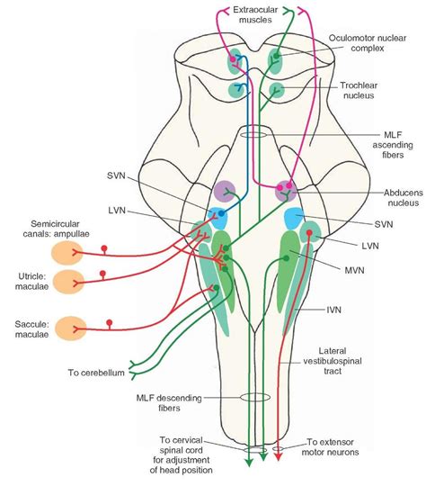 Lateral Pontine Syndrome