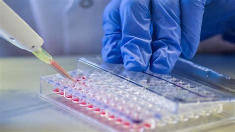 What is the Lateral Flow Assay Development Process?