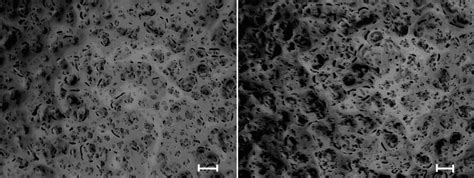 Optical microscopy images of HG2(1%)h (left) and HG2(1%)l (right)... | Download Scientific Diagram