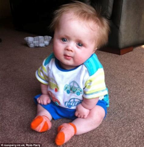 Boy, 3, is the only child in UK with Brody syndrome' an ultra-rare form of dwarfism | Daily Mail ...