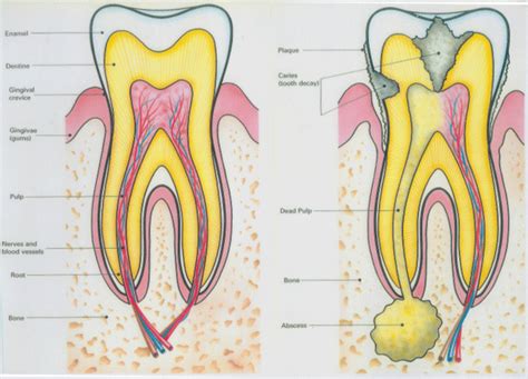 Toothache Dentist in Birmingham - Scott Arms