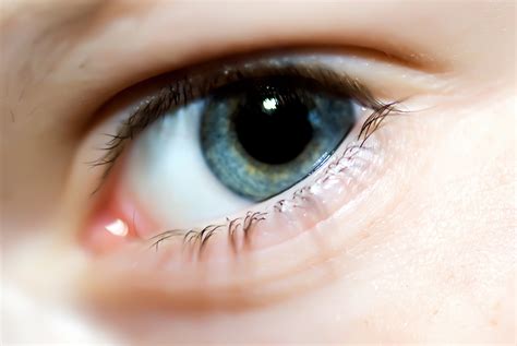 Eyelid Twitching: Causes, Treatment, and Prevention