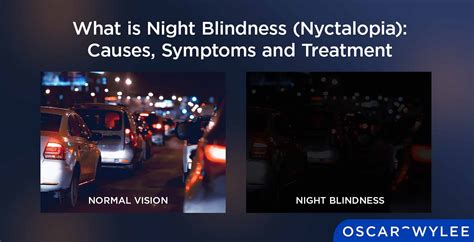 What is Night Blindness (Nyctalopia): Causes, Symptoms and Treatment