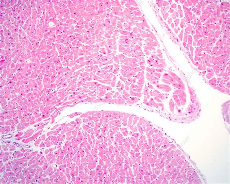 Heart Endocardium Histology